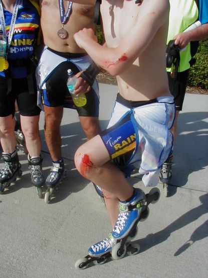 Murphy, doing the road-rash shuffle. Now you're initiated Murphy.