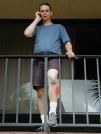 Peace breaks out in Orlando. You have to look closely at the knee bandage.
